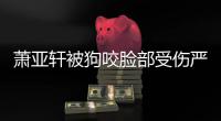 萧亚轩被狗咬脸部受伤严重真的吗？重新整容后已复原